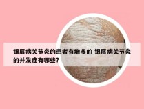 银屑病关节炎的患者有增多的 银屑病关节炎的并发症有哪些?
