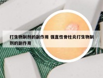 打生物制剂的副作用 强直性脊柱炎打生物制剂的副作用