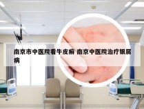 南京市中医院看牛皮癣 南京中医院治疗银屑病