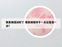 银屑病湿润好了 银屑病保持干一点还是湿一点?