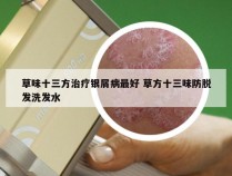 草味十三方治疗银屑病最好 草方十三味防脱发洗发水