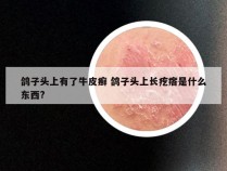 鸽子头上有了牛皮癣 鸽子头上长疙瘩是什么东西?
