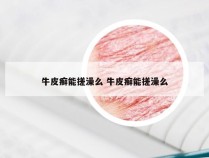 牛皮癣能搓澡么 牛皮癣能搓澡么