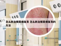 怎么防治银屑病复发 怎么防治银屑病复发的方法