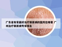 广东省有家最好治疗银屑病的医院在哪里 广州治疗银屑病专家排名