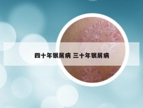 四十年银屑病 三十年银屑病