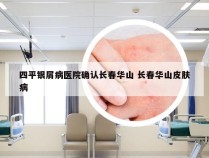 四平银屑病医院确认长春华山 长春华山皮肤病