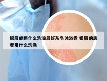银屑病用什么洗澡最好灰皂沐浴露 银屑病患者用什么洗澡