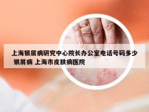 上海银屑病研究中心院长办公室电话号码多少 银屑病 上海市皮肤病医院