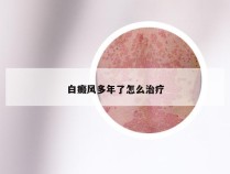 白癜风多年了怎么治疗