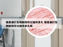 银屑病打生物制剂可以维持多久 银屑病打生物制剂可以维持多久呢
