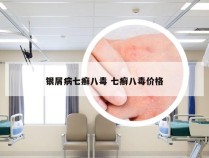 银屑病七癣八毒 七癣八毒价格