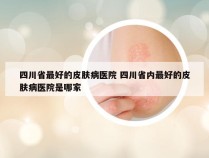 四川省最好的皮肤病医院 四川省内最好的皮肤病医院是哪家