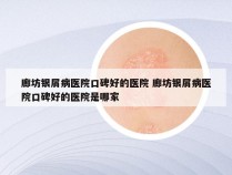 廊坊银屑病医院口碑好的医院 廊坊银屑病医院口碑好的医院是哪家