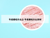 牛皮癣吃什么口 牛皮癣吃什么食材