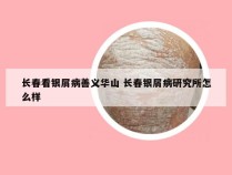 长春看银屑病善义华山 长春银屑病研究所怎么样