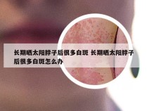 长期晒太阳脖子后很多白斑 长期晒太阳脖子后很多白斑怎么办