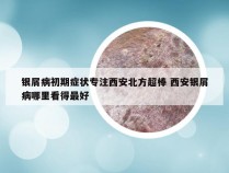 银屑病初期症状专注西安北方超棒 西安银屑病哪里看得最好