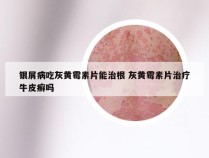 银屑病吃灰黄霉素片能治根 灰黄霉素片治疗牛皮癣吗