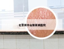 北京周中山银屑病医院
