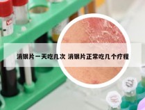 消银片一天吃几次 消银片正常吃几个疗程