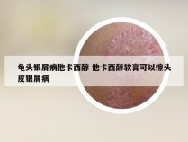 龟头银屑病他卡西醇 他卡西醇软膏可以擦头皮银屑病
