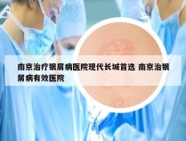 南京治疗银屑病医院现代长城首选 南京治银屑病有效医院