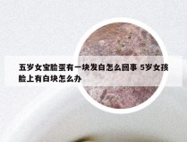 五岁女宝脸蛋有一块发白怎么回事 5岁女孩脸上有白块怎么办