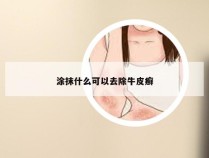 涂抹什么可以去除牛皮癣