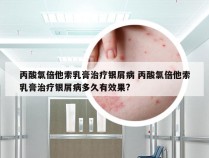 丙酸氯倍他索乳膏治疗银屑病 丙酸氯倍他索乳膏治疗银屑病多久有效果?