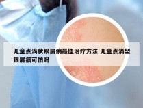儿童点滴状银屑病最佳治疗方法 儿童点滴型银屑病可怕吗