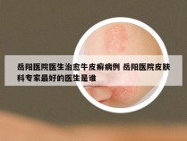 岳阳医院医生治愈牛皮癣病例 岳阳医院皮肤科专家最好的医生是谁