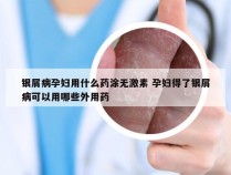 银屑病孕妇用什么药涂无激素 孕妇得了银屑病可以用哪些外用药