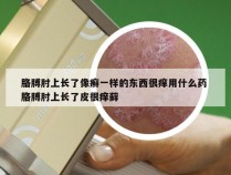 胳膊肘上长了像癣一样的东西很痒用什么药 胳膊肘上长了皮很痒藓
