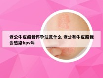 老公牛皮癣我怀孕注意什么 老公有牛皮廨我会感染hpv吗