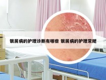 银屑病的护理诊断有哪些 银屑病的护理常规