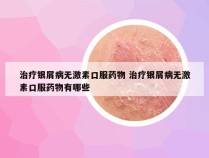 治疗银屑病无激素口服药物 治疗银屑病无激素口服药物有哪些