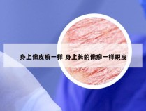 身上像皮癣一样 身上长的像癣一样蜕皮