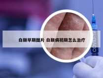 白颠早期图片 白颠病初期怎么治疗