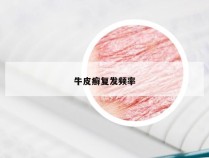 牛皮癣复发频率