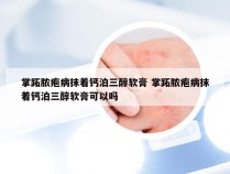 掌跖脓疱病抹着钙泊三醇软膏 掌跖脓疱病抹着钙泊三醇软膏可以吗
