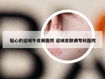 贴心的运城牛皮癣医院 运城皮肤病专科医院