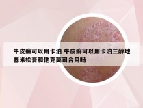 牛皮癣可以用卡泊 牛皮癣可以用卡泊三醇地塞米松膏和他克莫司合用吗