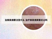 治银屑病要注意什么 治疗银屑病需要忌口吗