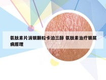 氨肽素片消银颗粒卡泊三醇 氨肽素治疗银屑病原理