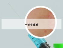 一岁牛皮癣