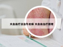 大自血疗法治牛皮癣 大自血治疗原理