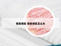 银屑病氧 银屑病氧怎么办