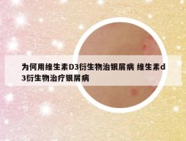 为何用维生素D3衍生物治银屑病 维生素d3衍生物治疗银屑病