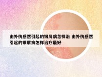 由外伤感然引起的银屑病怎样治 由外伤感然引起的银屑病怎样治疗最好